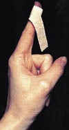 Fingerstrips Fingerstrips